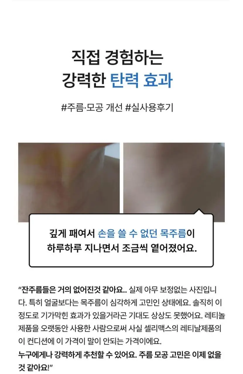 [모공탄력] 셀리맥스 더 비타 A 레티날 샷 타이트닝 부스터 15ml 상세페이지 2